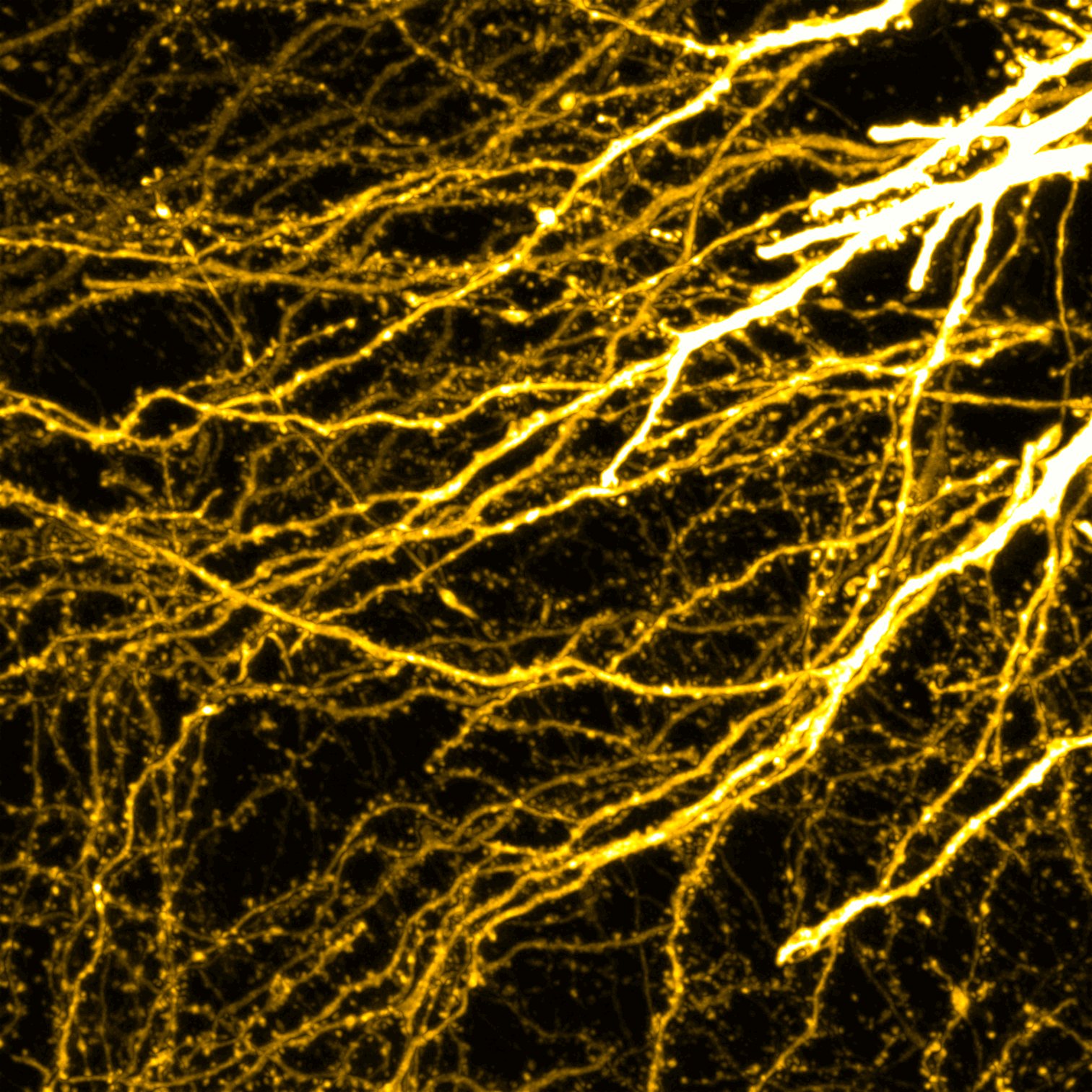 A dense, forest-like arborisation of dendrites in green fluorescence