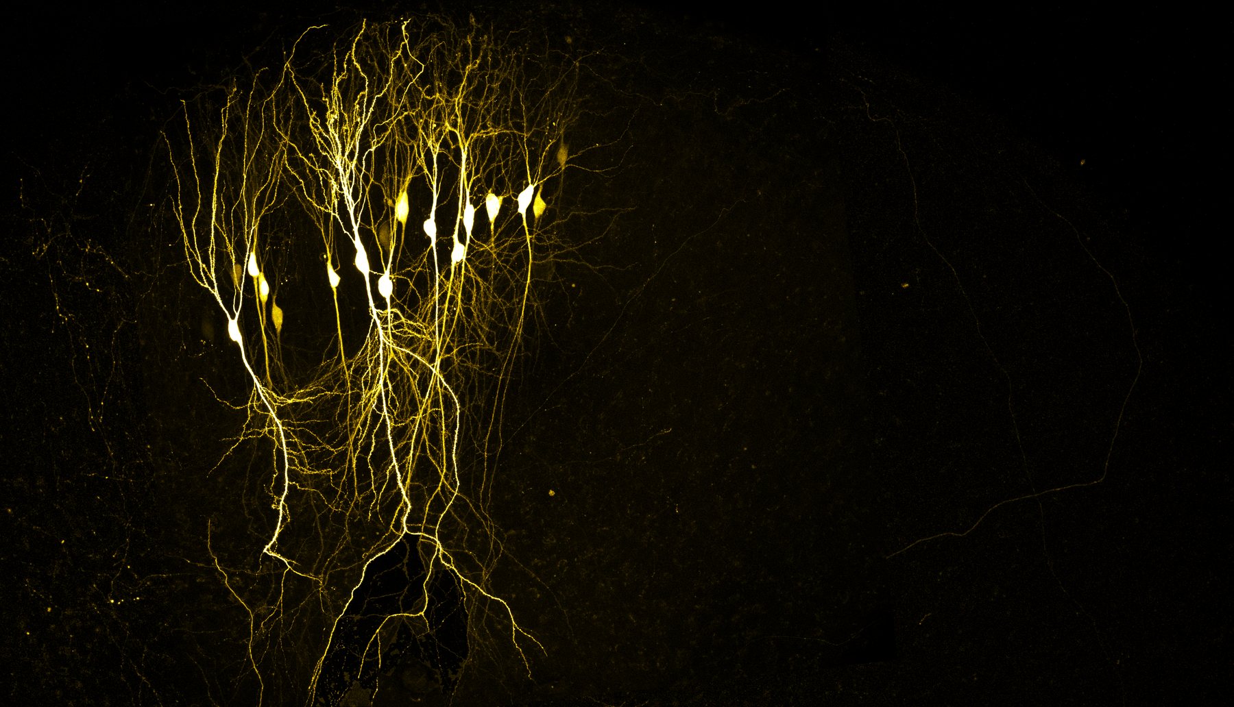 A row of pyramidal neurons filled and glowing yellow against a dark background