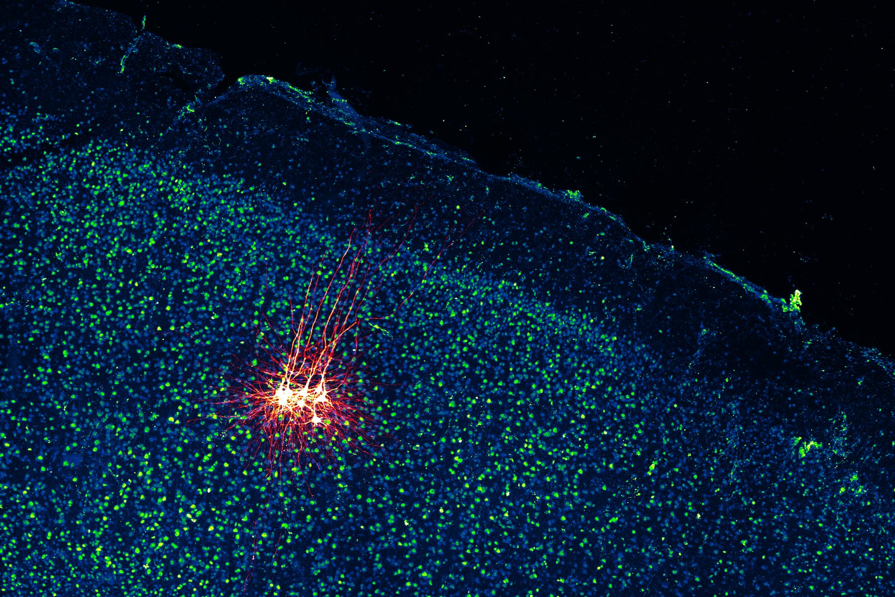 Recorded neurons filled with dye, glowing red against densely packed cell nuclei in human cortical tissue
