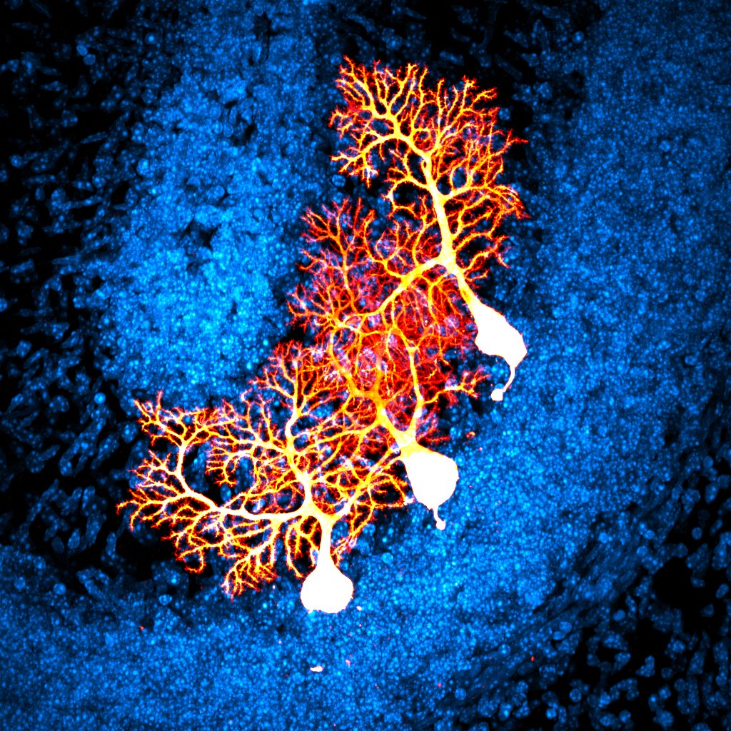 A Purkinje cell's dendritic tree, glowing orange against a blue cerebellar background