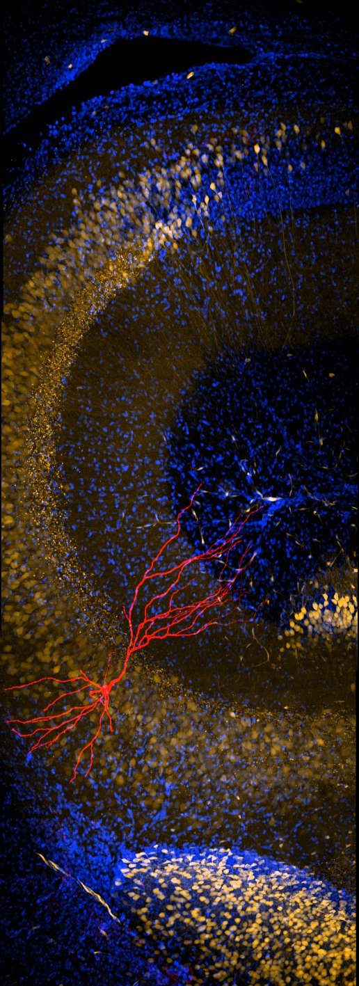 A single recorded neuron glowing against dark hippocampal tissue