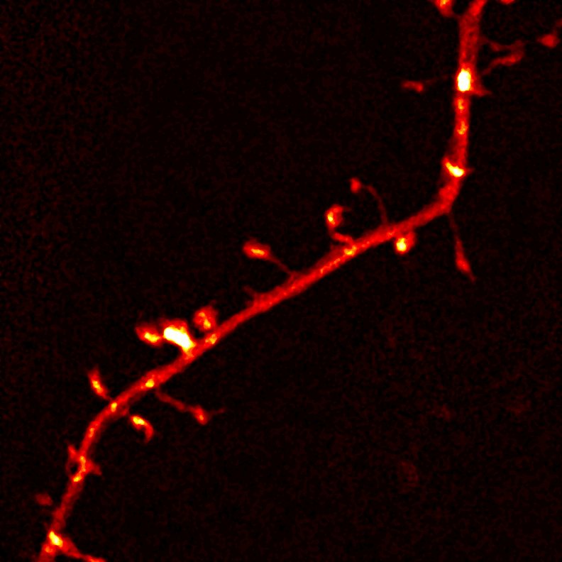 Super-resolution STED image of dendritic spines